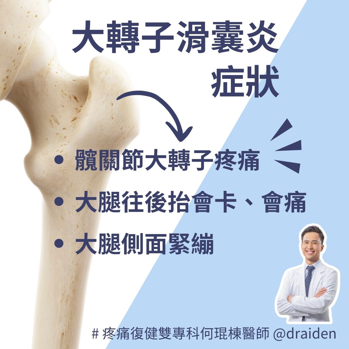 大轉子滑囊炎：症狀包含髖關節大轉子疼痛、大腿側面緊繃、走路會屁股痛