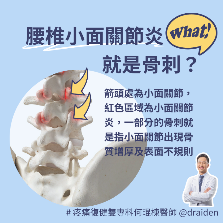 腰椎退小面關節炎與一部分的腰椎長骨刺相關