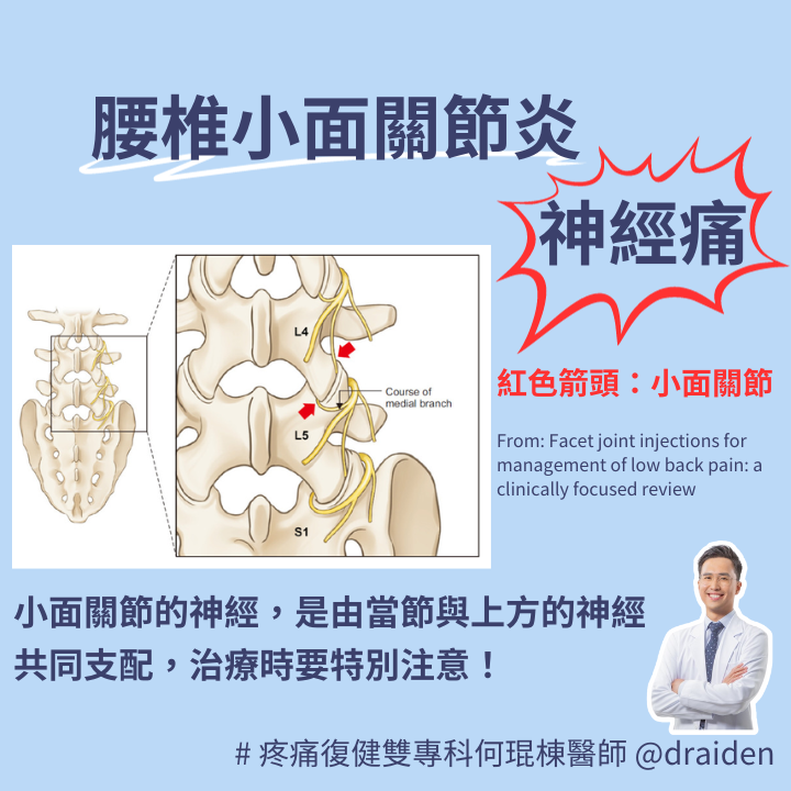 腰椎小面關節炎及骨刺會刺激到周圍神經