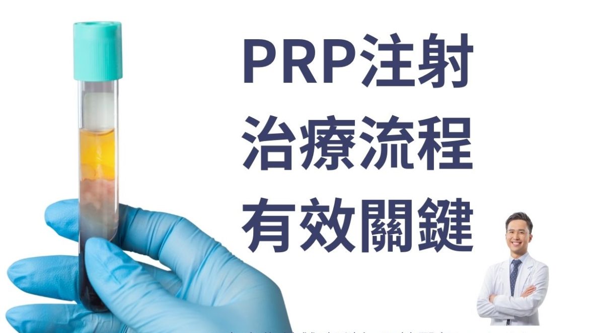 PRP注射治療流程及有效關鍵