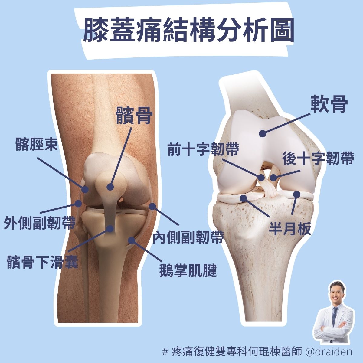 膝蓋痛位置解析 膝蓋痛不等於膝蓋退化 何琨棟醫師dr Aiden