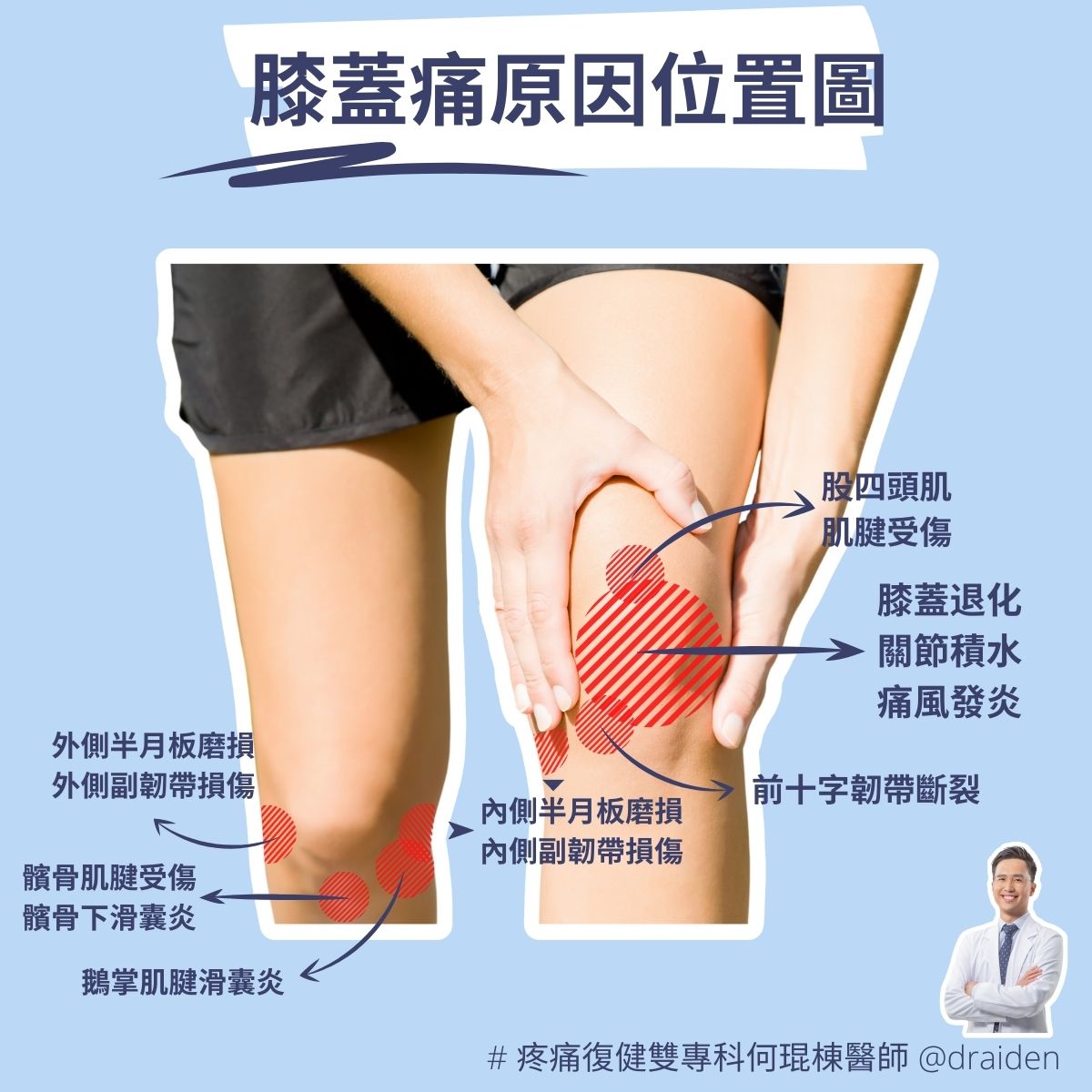 膝蓋痛原因位置對照圖