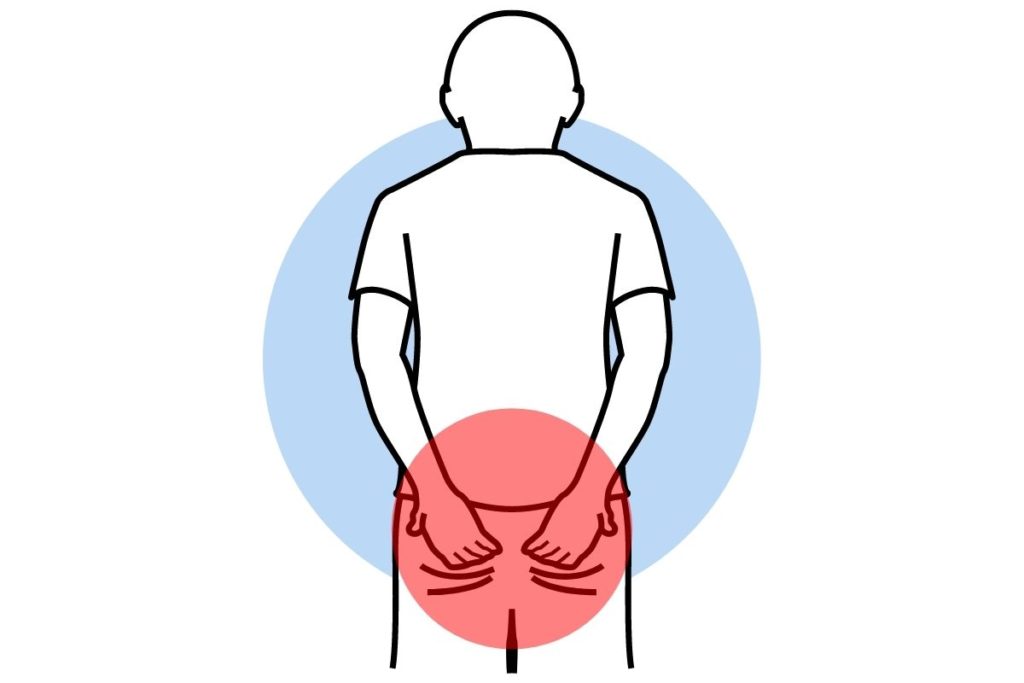 屁股疼痛常見原因 坐骨神經痛 臀部深處疼痛症候群 髖關節大轉子疼痛症候群