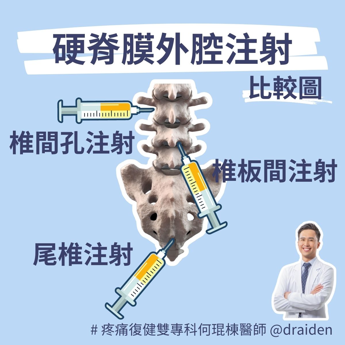 硬脊膜外腔注射包含椎間孔注射、椎板間注射、尾椎注射