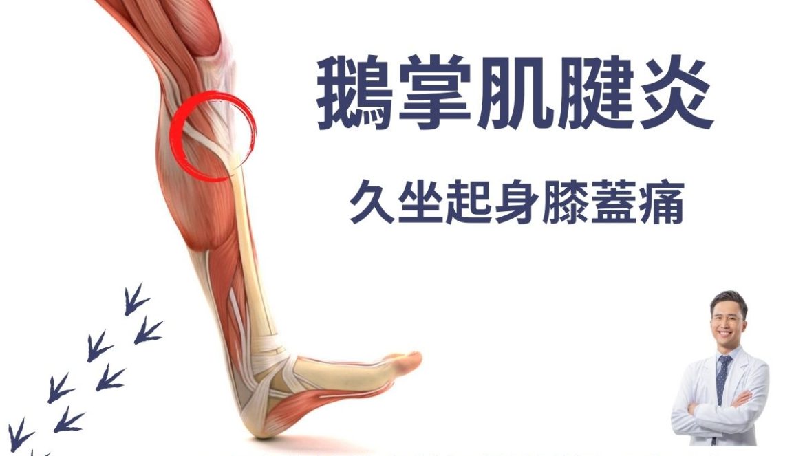 鵝掌肌腱炎其實是肌腱受傷或滑囊發炎